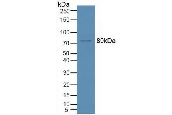 SMPD1 Antikörper  (AA 319-579)