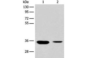 Western blot analysis of Mouse liver tissue and Human fetal liver tissue lysates using RGN Polyclonal Antibody at dilution of 1:500 (Regucalcin antibody)