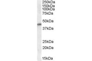 Anti-CSX1 (0. (NK2 Homeobox 5 antibody  (Internal Region))