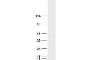 Validation with Western Blot (DNASEX Protein (Transcript Variant 4) (Myc-DYKDDDDK Tag))