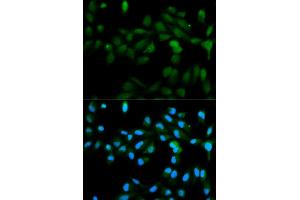Immunofluorescence analysis of MCF-7 cells using CYP11A1 antibody (ABIN5970856). (CYP11A1 antibody)