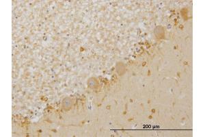 Immunoperoxidase of monoclonal antibody to LIMK1 on formalin-fixed paraffin-embedded human cerebellum. (LIM Domain Kinase 1 antibody  (AA 548-647))