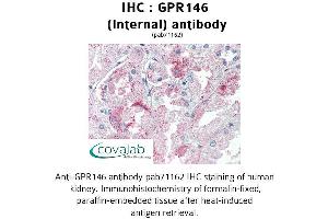 Image no. 3 for anti-G Protein-Coupled Receptor 146 (GPR146) (Internal Region) antibody (ABIN1734950)