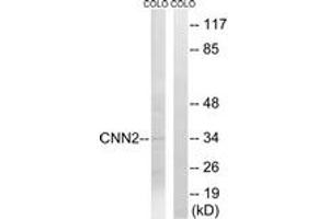 Western blot analysis of extracts from COLO cells, using CNN2 Antibody. (CNN2 antibody  (AA 121-170))