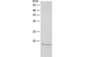 Western Blotting (WB) image for Kidney Associated Antigen 1 (KAAG1) (AA 1-84) protein (His-IF2DI Tag) (ABIN7289220) (KAAG1 Protein (AA 1-84) (His-IF2DI Tag))