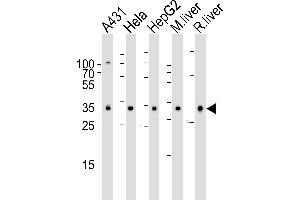 Western blot analysis of lysates from A431, Hela, HepG2 cell line , mouse liver and rat liver tissue lysate(from left to right), using CYB5R3 Antibody (Center) (ABIN6242253 and ABIN6577413). (CYB5R3 antibody  (AA 111-144))