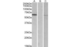 HEK293 lysate (10ug protein in RIPA buffer) over expressing Human MKRN1 with DYKDDDDK tag probed with ABIN2563878 (0. (MKRN1 antibody  (AA 105-118))