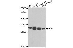 Western blot analysis of extracts of various cell lines, using RPS3 antibody. (RPS3 antibody  (AA 1-243))