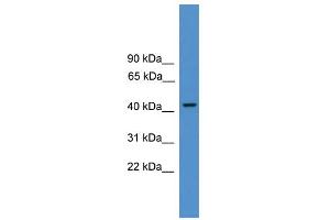 WB Suggested Anti-PSMC3  Antibody Titration: 0. (PSMC3 antibody  (N-Term))