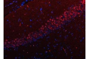 IF analysis of RFX3 using anti-RFX3 antibody (ABIN7601095).
