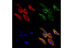 ABIN6261947 and ABIN6276873 staining Hela cells by IF/ICC.