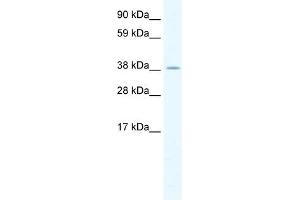 HSFY2 antibody (20R-1152) used at 0. (HSFY2 antibody  (C-Term))