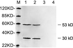 Western blot analysis of cell lysates using 1 µg/mL Rabbit Anti-Vimentin Polyclonal Antibody (ABIN398721) Lane 1, 3: Hela cell lysateLane 2, 4: HEK293 cell lysate Primary antibody: Lane 1, 2: Rabbit Anti-Vimentin Polyclonal AntibodyLane 3, 4: Rabbit Anti-Vimentin Polyclonal Antibody pre-incubated with immunizing peptideThe signal was developed with IRDyeTM 800 Conjugated Goat Anti-Rabbit IgG.