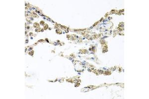 Immunohistochemistry of paraffin-embedded human lung using PIK3CB antibody (ABIN5970370) at dilution of 1/100 (40x lens). (PIK3CB antibody)