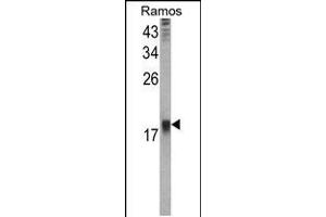 Western blot analysis of UBE2B Antibody in Ramos cell line lysates (35ug/lane) (UBE2B antibody  (C-Term))