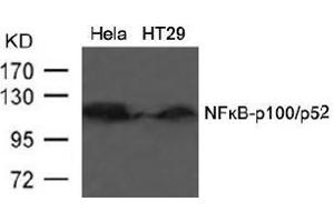 Image no. 3 for anti-Nuclear Factor of kappa Light Polypeptide Gene Enhancer in B-Cells 2 (NFKB2) (AA 864-868) antibody (ABIN197118) (NFKB2 antibody  (AA 864-868))
