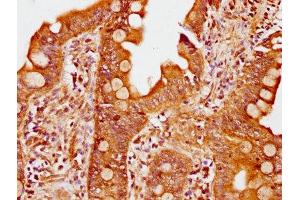 Immunohistochemistry (IHC) image for anti-Phosphoinositide-3-Kinase, Regulatory Subunit 6 (PIK3R6) (AA 566-667), (Regulatory Subunit 6) antibody (ABIN7163299)