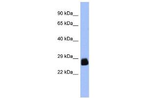 WB Suggested Anti-PDX1  Antibody Titration: 0.