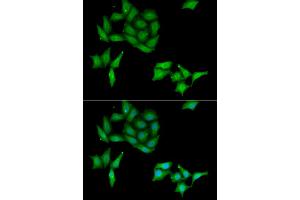 Immunofluorescence analysis of HeLa cells using CCNC antibody. (Cyclin C antibody)