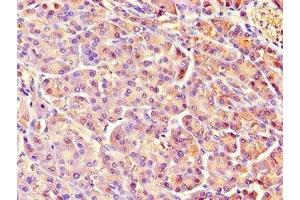 Immunohistochemistry of paraffin-embedded human pancreatic tissue using ABIN7158464 at dilution of 1:100 (REG1A antibody  (AA 23-166))
