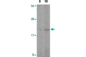 Western blot analysis of FAIM in human spleen tissue lysate with FAIM polyclonal antibody  at 5 and 10 ug/mL . (FAIM antibody  (C-Term))