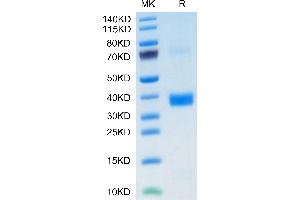 SDS-PAGE (SDS) image for Apolipoprotein E3 (ApoE3) (AA 19-317) protein (His tag,Biotin) (ABIN7273866)