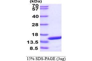 SDS-PAGE (SDS) image for Peripheral Myelin Protein 2 (PMP2) (AA 1-132) protein (ABIN667720)