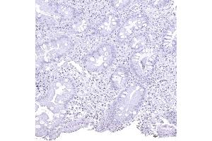 Complete absence of helicobacter pylori in a stomach biopsy (Helicobacter Pylori antibody  (AA 323-445))