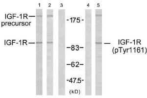 Western blot analysis using IGF-1R (Ab-1161) antibody (E021080, Line 1, 2 and 3) and IGF-1R (phospho-Tyr1161) antibody (E011087, Line 4 and 5). (IGF1R antibody  (pTyr1161))