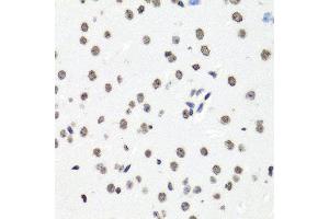 Immunohistochemistry of paraffin-embedded mouse brain using HIST1H2BG antibody (ABIN6003628) at dilution of 1/100 (40x lens). (HIST1H2BG antibody)