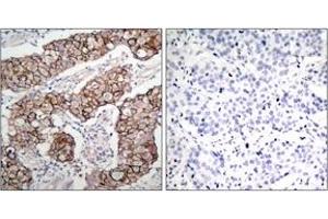 Immunohistochemistry (IHC) image for anti-Epidermal Growth Factor Receptor (EGFR) (pTyr1092) antibody (ABIN2888397) (EGFR antibody  (pTyr1092))