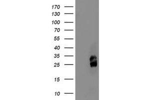 HEK293T cells were transfected with the pCMV6-ENTRY control (Left lane) or pCMV6-ENTRY PMVK (Right lane) cDNA for 48 hrs and lysed. (PMVK antibody)
