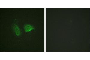 P-peptide - +Western blot analysis of extracts from LOVO cells, using Calcium Sensing Receptor (Phospho-Thr888) antibody. (CASR antibody  (pThr888))