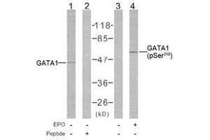 Image no. 1 for anti-GATA Binding Protein 1 (Globin Transcription Factor 1) (GATA1) (pSer310) antibody (ABIN2621191) (GATA1 antibody  (pSer310))