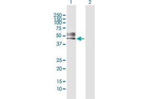 Western Blot analysis of RTN4R expression in transfected 293T cell line by RTN4R MaxPab polyclonal antibody. (RTN4R antibody  (AA 1-473))