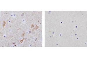 Immunohistochemistry analysis of human brain tissue slide (Paraffin embedded) using Rabbit Anti-NSE Polyclonal Antibody (Left, ABIN398881) and Purified Rabbit IgG (Whole molecule) Control (Right, ABIN398653) (ENO2/NSE antibody  (C-Term))
