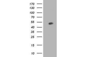 HEK293T cells were transfected with the pCMV6-ENTRY control (Left lane) or pCMV6-ENTRY BECN1 (Right lane) cDNA for 48 hrs and lysed. (Beclin 1 antibody)