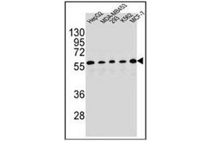 Western blot analysis of PAX1 Antibody (C-term) in HepG2, MDA-MB453, 293, K562, MCF-7 cell line lysates (35ug/lane). (PAX1 antibody  (C-Term))