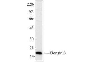 Western Blotting (WB) image for anti-Transcription Elongation Factor B (SIII), Polypeptide 2 (18kDa, Elongin B) (TCEB2) antibody (ABIN2666332) (TCEB2 antibody)