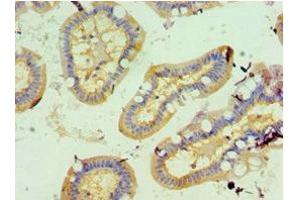 Immunohistochemistry of paraffin-embedded human small intestine tissue using ABIN7153890 at dilution of 1:100 (GCK antibody  (AA 1-300))