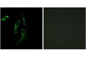 Immunofluorescence analysis of HepG2/HeLa cells, using HARS Antibody. (HARS1/Jo-1 antibody  (AA 460-509))