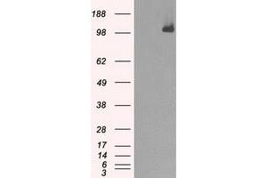 Image no. 5 for anti-Budding Uninhibited By Benzimidazoles 1 Homolog beta (Yeast) (BUB1B) antibody (ABIN1496995) (BUB1B antibody)