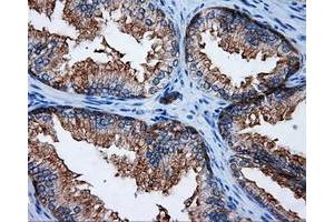 Immunohistochemical staining of paraffin-embedded Kidney tissue using anti-RALBP1 mouse monoclonal antibody. (RALBP1 antibody)