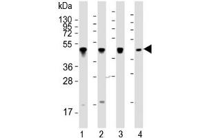 Western Blotting (WB) image for anti-Keratin 18 (KRT18) (AA 401-430) antibody (ABIN3031537)