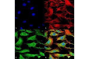 Immunocytochemistry/Immunofluorescence analysis using Mouse Anti-Copper Transporting ATPase 2 Monoclonal Antibody, Clone S62-29 . (ATP7B antibody  (AA 3-21) (Biotin))