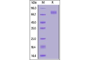 SARS-CoV-2 S2 protein (T716I, S982A, D1118H), His Tag on  under reducing (R) condition.