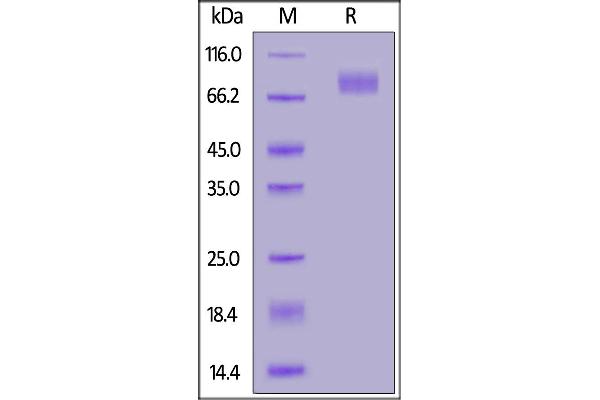SARS-CoV-2 Spike S2 Protein (B.1.1.7 - alpha) (His tag)