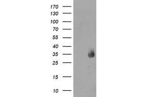 Western Blotting (WB) image for anti-Methylmalonic Aciduria (Cobalamin Deficiency) CblC Type, with Homocystinuria (MMACHC) antibody (ABIN1499512) (MMACHC antibody)