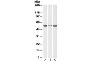 Western blot testing of human [A] and mouse [B] liver, and rat [C] testis lysate with ALDH1A1 antibody at 0. (ALDH1A1 antibody)