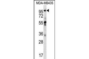 CTAGE5 Antibody (C-term) (ABIN656676 and ABIN2845915) western blot analysis in MDA-M cell line lysates (35 μg/lane).